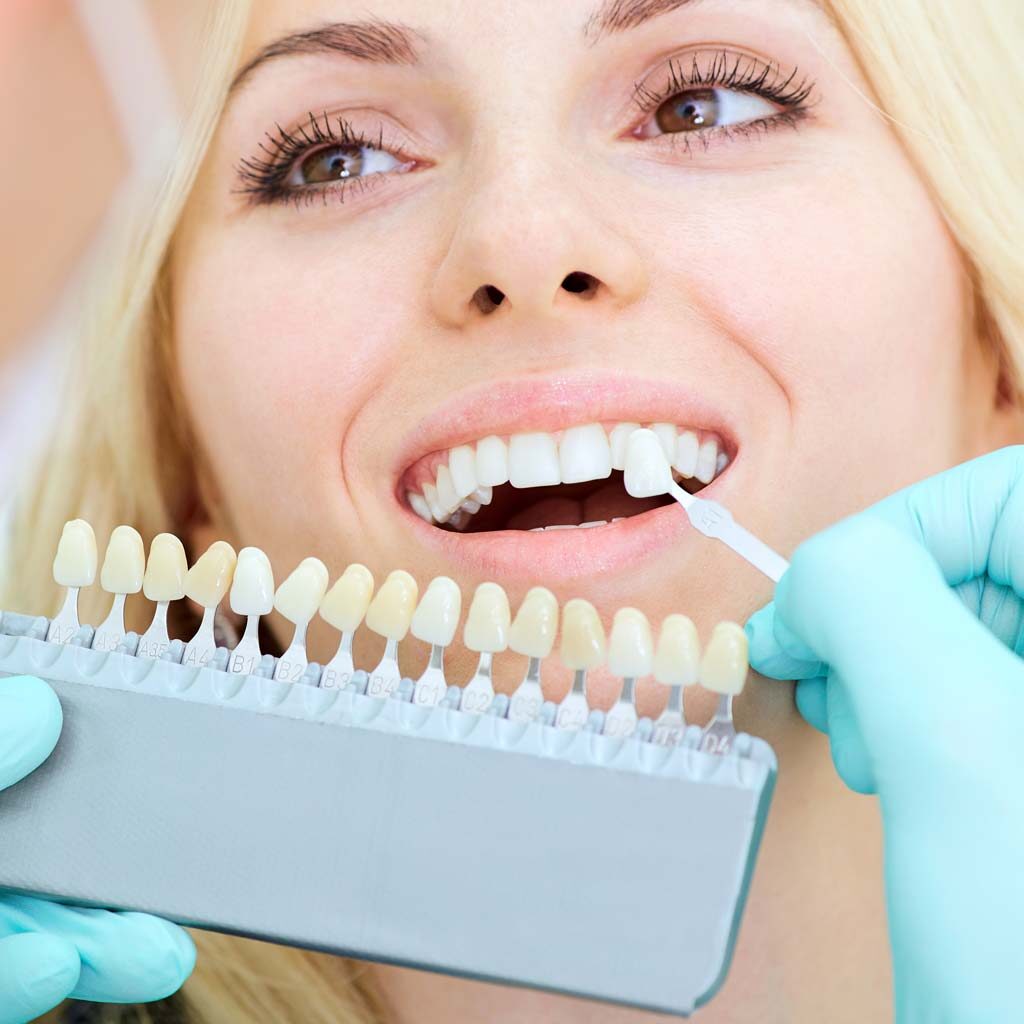 Dentist helping woman pick out veneer shell